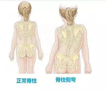 久坐會造成脊柱問題，影響兒童成長