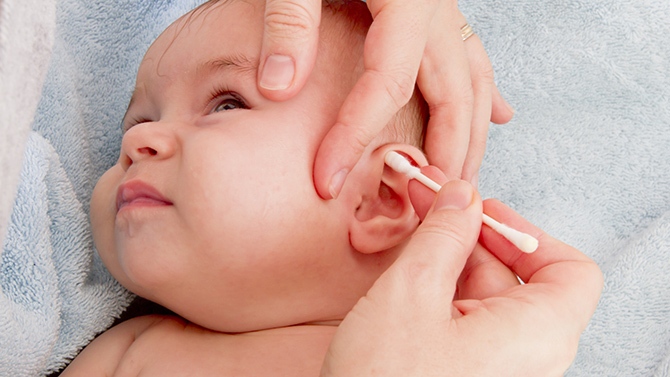 寶寶耳屎要不要取視癥狀而定 耵聹栓塞不可忽視