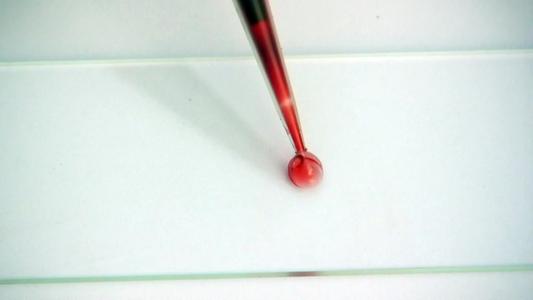 滴血可驗(yàn)！鐘南山團(tuán)隊(duì)研發(fā)快速便捷檢測試劑