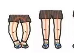 寶寶走路“八字腳”？或是因?yàn)榧议L做錯(cuò)了這些事！