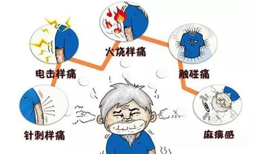 專家教你科學(xué)防治帶狀皰疹 小小水泡為何讓人痛不欲生？