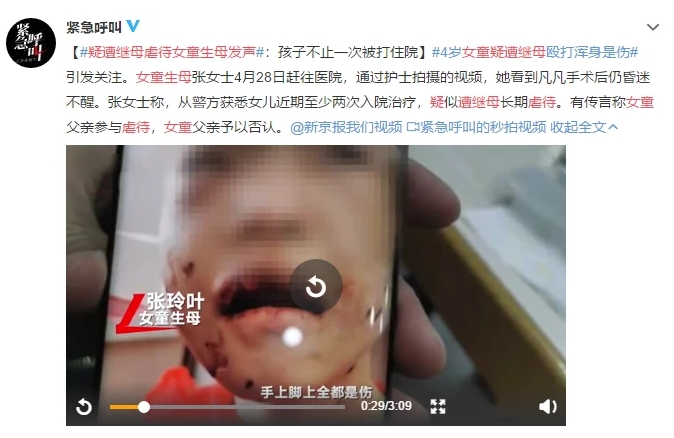 4歲女童疑遭繼母毆打重傷進(jìn)ICU：虐童案頻發(fā)，除了憤怒我們更應(yīng)該站出來