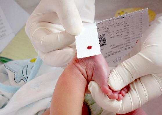 新生兒為何一定要化驗(yàn)“足跟血”？關(guān)系到孩子的一生智力發(fā)育