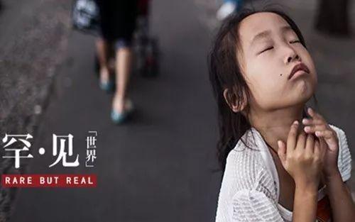 人大代表建議將兒童罕見病用藥納入醫(yī)保 什么是罕見病?