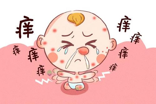 寶寶過敏知多少?家長(zhǎng)要做好寶寶過敏防范