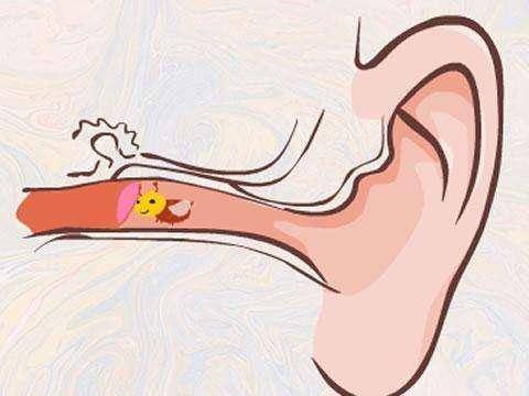 科學預防丨小孩耳朵進了蟲子家長應(yīng)該怎么做?