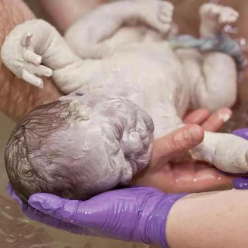 寶寶剛出生時身上一層白白的是什么？需要清理嗎？