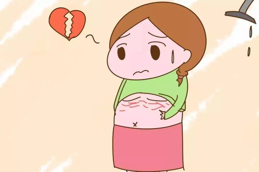 令人煩惱的妊娠紋，怎么才能預(yù)防呢？