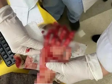 趁媽媽不注意，女孩將手伸進(jìn)了絞肉機(jī)，血的教訓(xùn)！