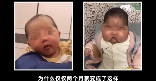 “大頭娃娃”重現(xiàn)，原因竟然是嬰兒霜激素超標(biāo)