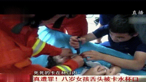來自喝水杯的惡意，8歲女孩舌頭被水杯口卡住，險被夾斷