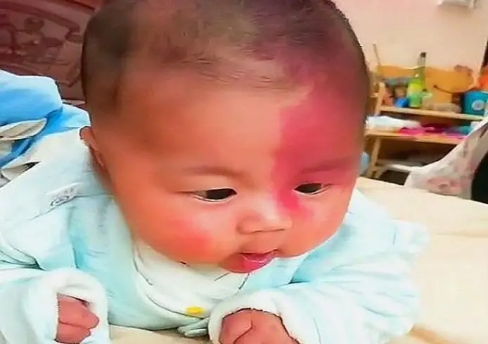 為了避免新生兒有胎記，孕期準(zhǔn)媽媽最好避開這3種行為