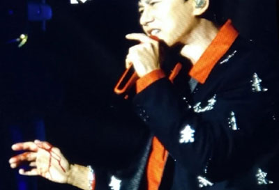 張杰舞臺事故受傷，去醫(yī)院前還在關(guān)心是否嚇到了孩子