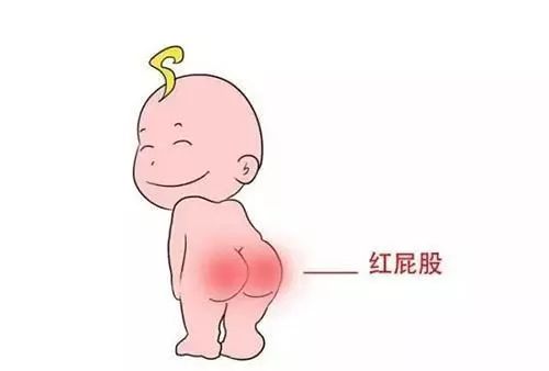 做好這三點，寶寶遠(yuǎn)離“紅屁股”