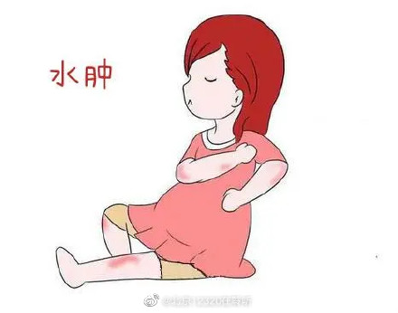 孕期生理性水腫和病理性水腫怎么區(qū)分？