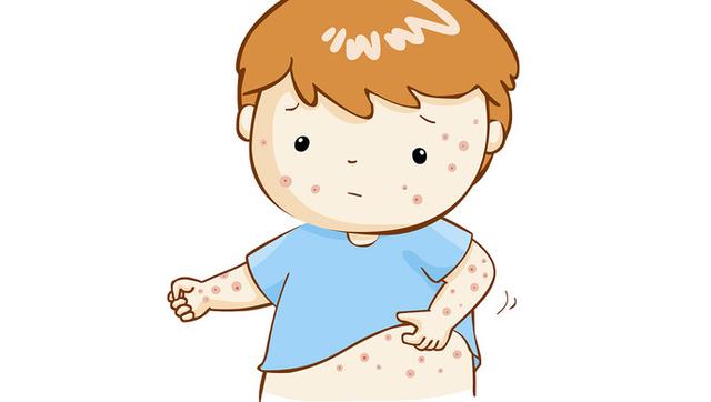 伏天皮膚科“一號(hào)疾病”易高發(fā)，孩子中招了怎么辦？