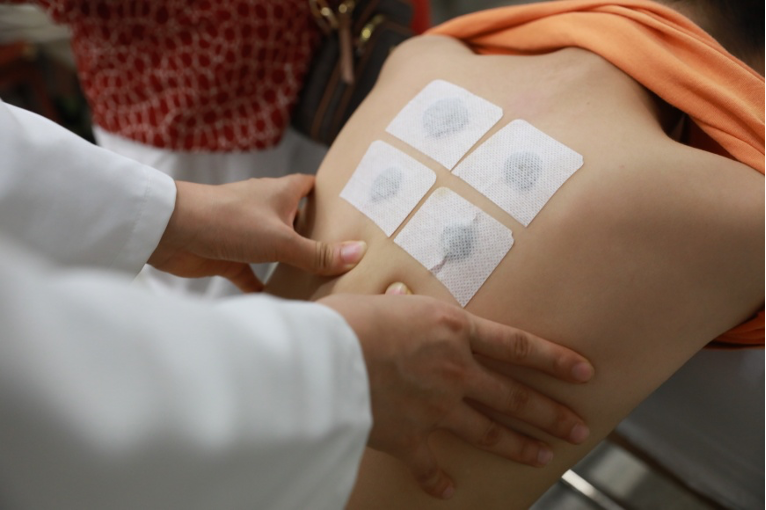 三伏貼開貼！高溫天對三伏貼效果增加助力