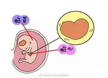 孕媽B超單子上的“胎心”是什么意思？