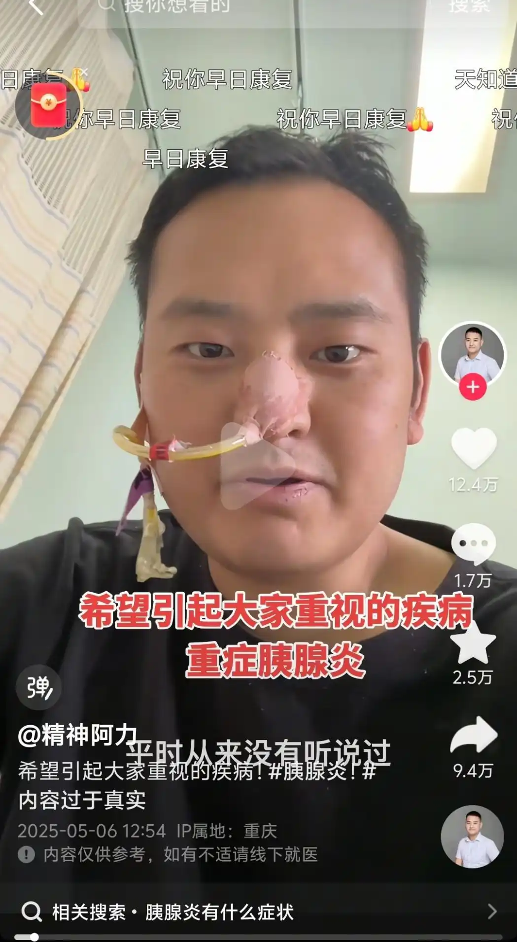 放縱飲食，須警惕“重癥急性胰腺炎”這個(gè)健康殺手